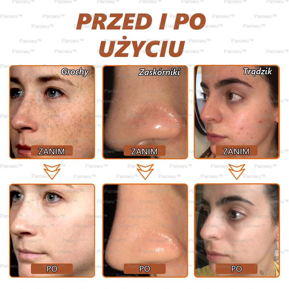 ☀️🌙Parowu™ Wybielająca i Rozjaśniająca Maska - Naturalne składniki trwale usuwają plamy, piegi i przebarwienia