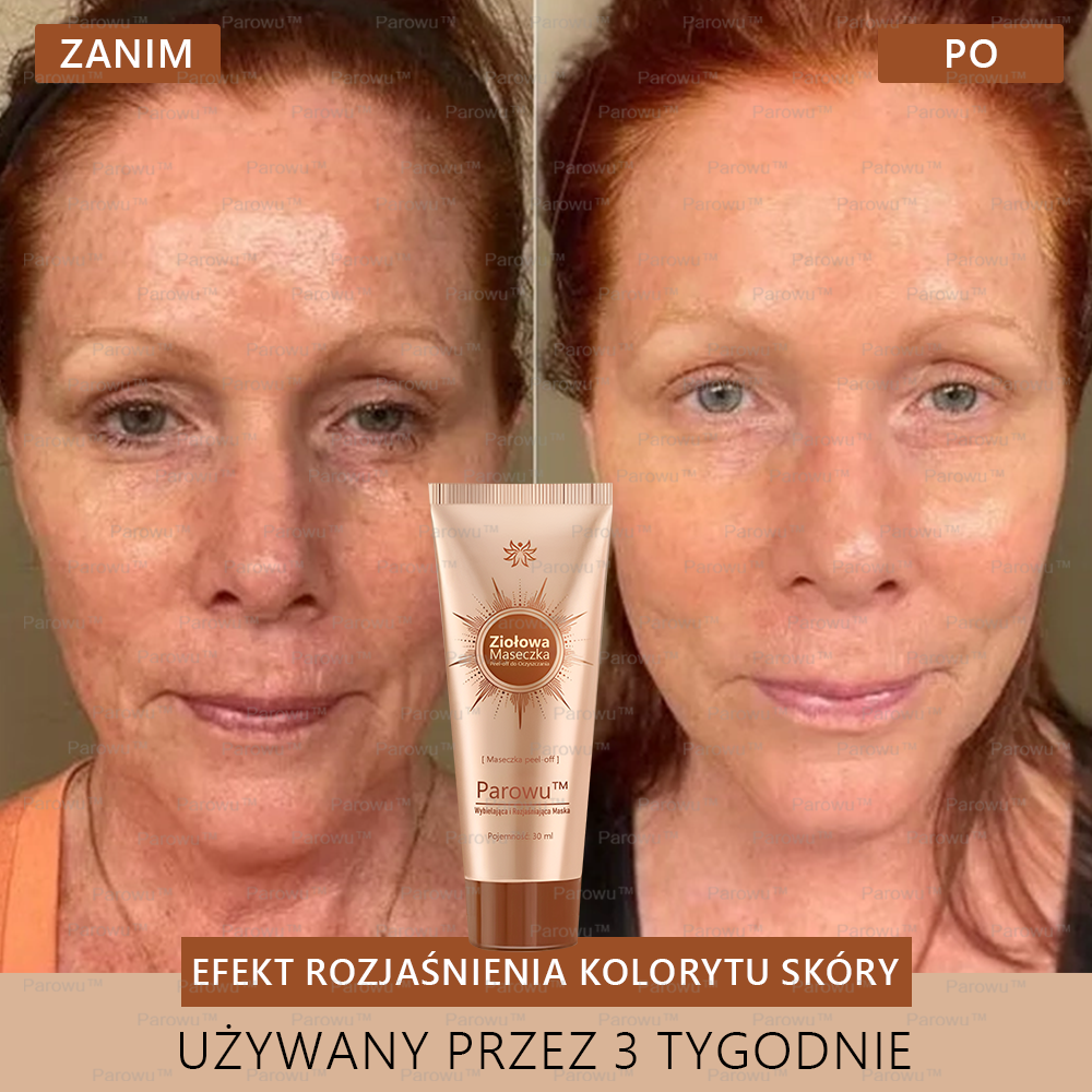 ☀️🌙Parowu™ Wybielająca i Rozjaśniająca Maska - Naturalne składniki trwale usuwają plamy, piegi i przebarwienia