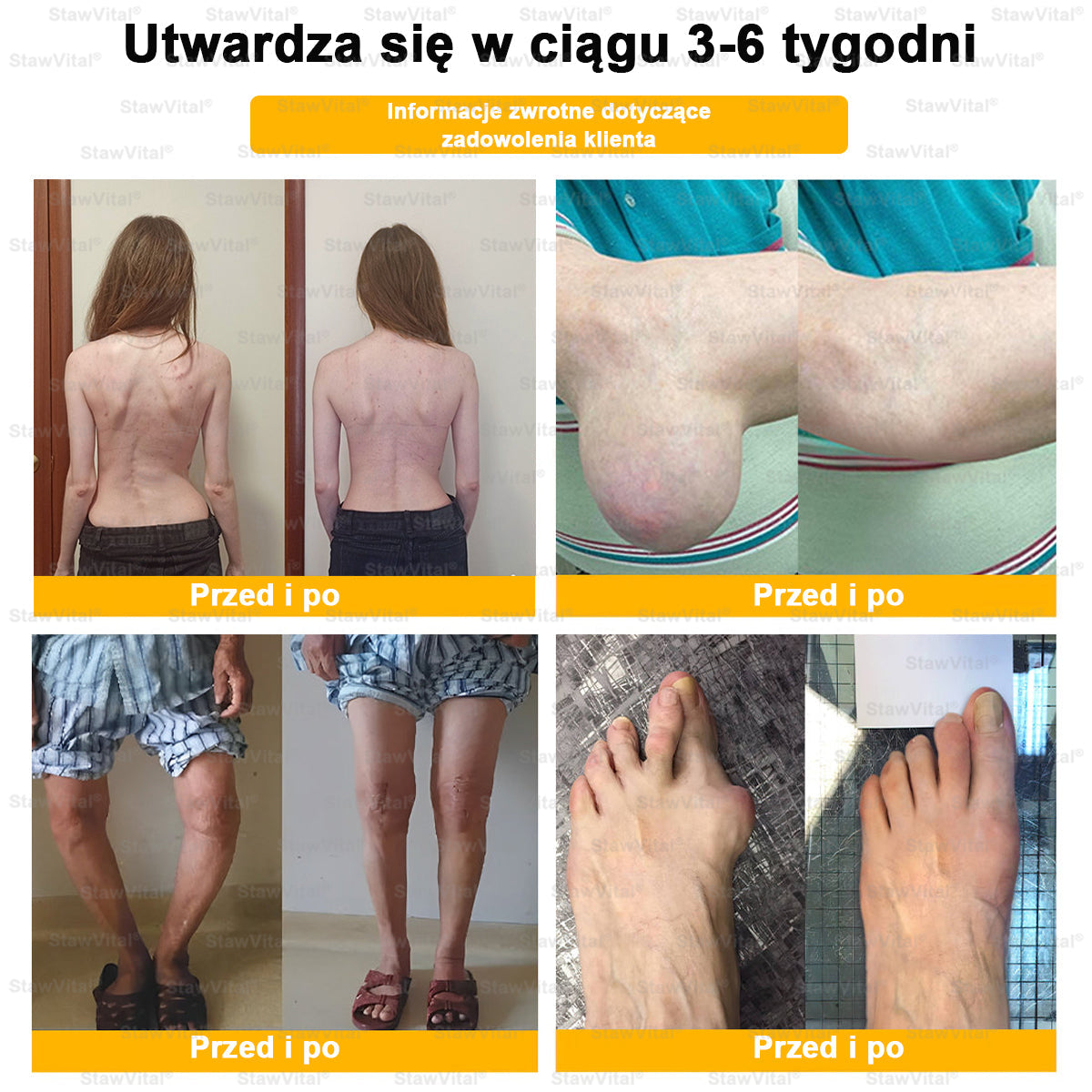 𝑺𝒕𝒂𝒘𝑽𝒊𝒕𝒂𝒍® 𝑲𝒓𝒆𝒎 𝒛 𝑱𝒂𝒅𝒆𝒎 𝑷𝒔𝒛𝒄𝒛𝒆𝒍𝒊𝒎 𝑳𝒆𝒄𝒛𝒏𝒊𝒄𝒛𝒚 𝒅𝒐 𝑹𝒆𝒈𝒆𝒏𝒆𝒓𝒂𝒄𝒋𝒊 𝑺𝒕𝒂𝒘ó𝒘 👨‍⚕️Certyfikowany przez Polskie Towarzystwo Ortopedyczne i Traumatologiczne (PTOiTr)