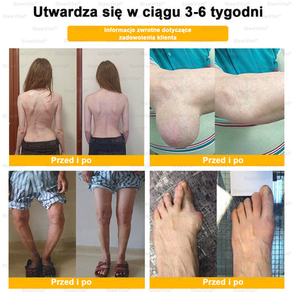 𝑺𝒕𝒂𝒘𝑽𝒊𝒕𝒂𝒍® 𝑲𝒓𝒆𝒎 𝒛 𝑱𝒂𝒅𝒆𝒎 𝑷𝒔𝒛𝒄𝒛𝒆𝒍𝒊𝒎 𝑳𝒆𝒄𝒛𝒏𝒊𝒄𝒛𝒚 𝒅𝒐 𝑹𝒆𝒈𝒆𝒏𝒆𝒓𝒂𝒄𝒋𝒊 𝑺𝒕𝒂𝒘ó𝒘 👨‍⚕️Certyfikowany przez Polskie Towarzystwo Ortopedyczne i Traumatologiczne (PTOiTr)