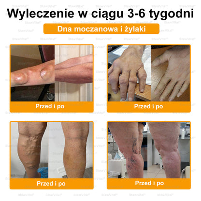 𝑺𝒕𝒂𝒘𝑽𝒊𝒕𝒂𝒍® 𝑲𝒓𝒆𝒎 𝒛 𝑱𝒂𝒅𝒆𝒎 𝑷𝒔𝒛𝒄𝒛𝒆𝒍𝒊𝒎 𝑳𝒆𝒄𝒛𝒏𝒊𝒄𝒛𝒚 𝒅𝒐 𝑹𝒆𝒈𝒆𝒏𝒆𝒓𝒂𝒄𝒋𝒊 𝑺𝒕𝒂𝒘ó𝒘 👨‍⚕️Certyfikowany przez Polskie Towarzystwo Ortopedyczne i Traumatologiczne (PTOiTr)