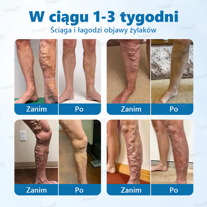 Dziękujemy za zaufanie!💐 Dziś została Pani jedną z naszych wyjątkowych klientek — z tej okazji oferujemy dodatkowy rabat -50%. To nasz wyraz troski o Pani zdrowie i codzienny komfort. 👉 Zamów bez obaw — Pani nogi z pewnością to docenią.🔥Trimil®