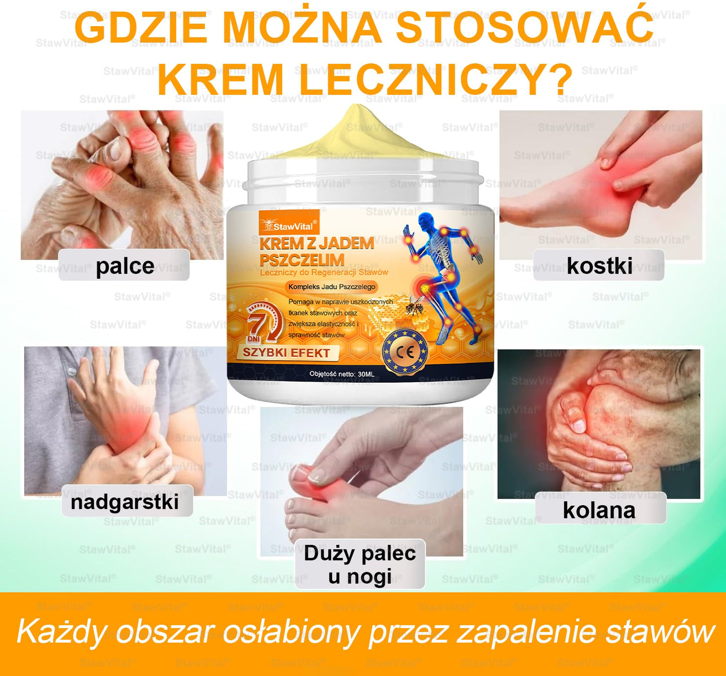 𝑺𝒕𝒂𝒘𝑽𝒊𝒕𝒂𝒍® – 𝑲𝒓𝒆𝒎 𝒛 𝑱𝒂𝒅𝒆𝒎 𝑷𝒔𝒛𝒄𝒛𝒆𝒍𝒊𝒎 𝑳𝒆𝒄𝒛𝒏𝒊𝒄𝒛𝒚 𝒅𝒐 𝑹𝒆𝒈𝒆𝒏𝒆𝒓𝒂𝒄𝒋𝒊 𝑺𝒕𝒂𝒘ó𝒘 (𝒆𝒌𝒔𝒕𝒓𝒂𝒌𝒕 𝒛 𝒑𝒔𝒛𝒄𝒛𝒐ł𝒚 𝒏𝒐𝒘𝒐𝒛𝒆𝒍𝒂𝒏𝒅𝒛𝒌𝒊𝒆𝒋 - 𝒘𝒚𝒔𝒑𝒆𝒄𝒋𝒂𝒍𝒊𝒛𝒐𝒘𝒂𝒏𝒚 𝒘 𝒍𝒆𝒄𝒛𝒆𝒏𝒊𝒖 𝒔𝒄𝒉𝒐𝒓𝒛𝒆ń 𝒐𝒓𝒕𝒐𝒑𝒆𝒅𝒚𝒄𝒛𝒏𝒚𝒄𝒉 𝒊 𝒃ó𝒍𝒖 𝒔𝒕𝒂𝒘ó𝒘)