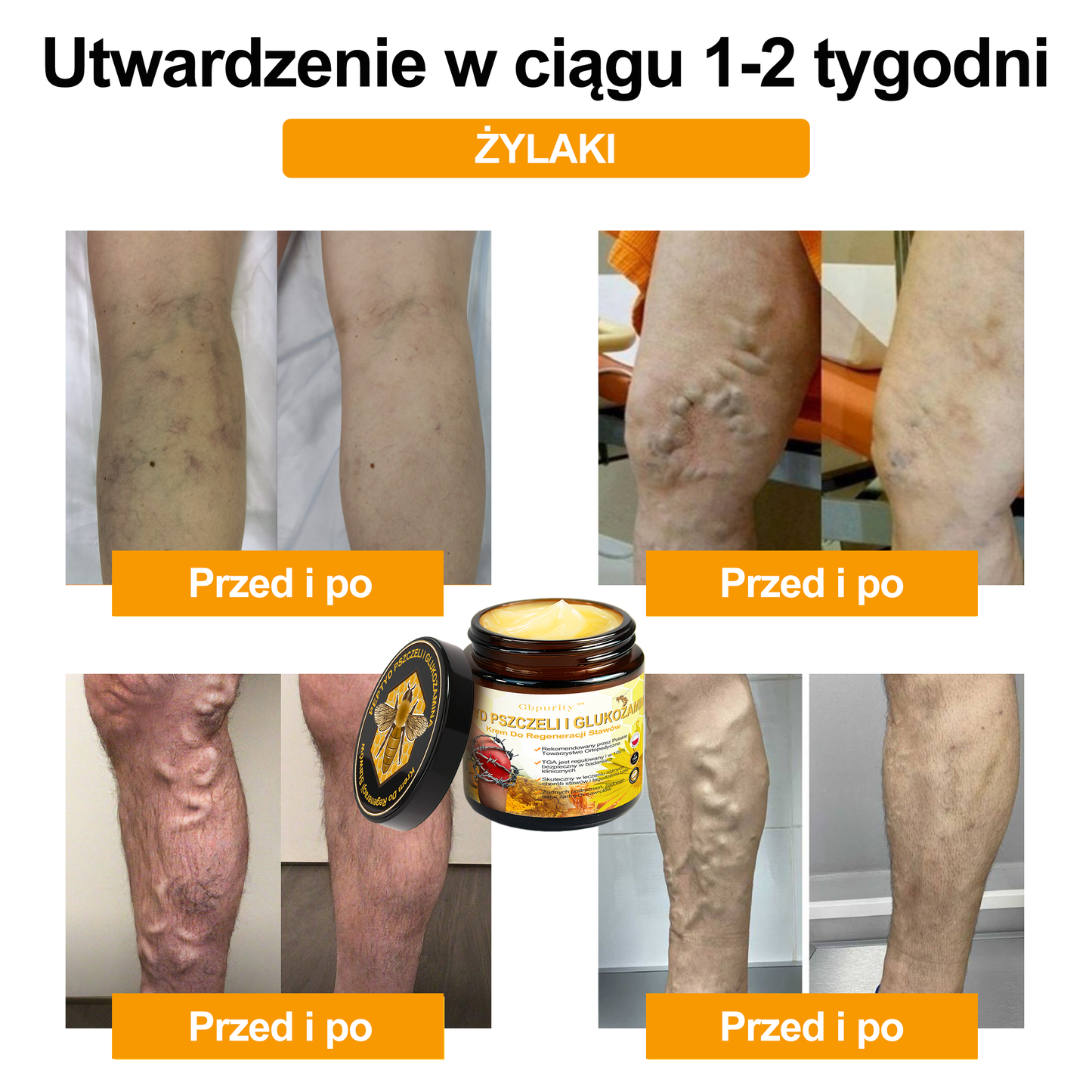 🎉 Gratulacje! Zostałaś dzisiejszą szczęśliwą klientką! Z tej okazji oferujemy Ci dodatkowy rabat 50%! Nie przegap tej szansy – jeśli dziś nie skorzystasz, będziesz musiała poczekać do przyszłego roku!🛡️Gbpurity™