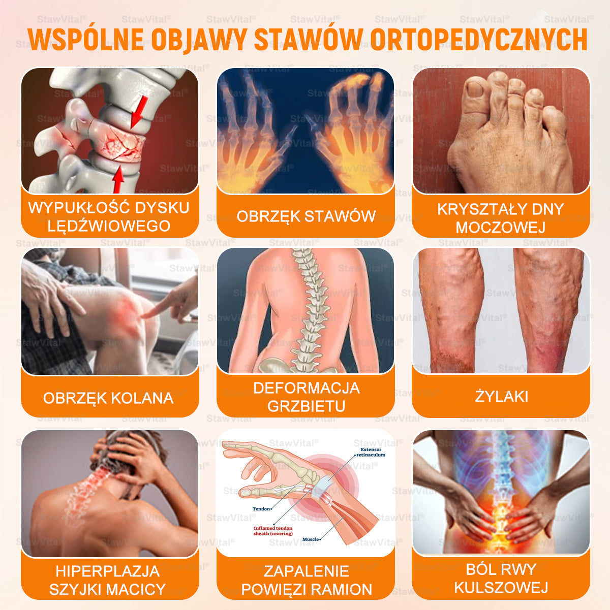 𝑺𝒕𝒂𝒘𝑽𝒊𝒕𝒂𝒍® 𝑲𝒓𝒆𝒎 𝒛 𝑱𝒂𝒅𝒆𝒎 𝑷𝒔𝒛𝒄𝒛𝒆𝒍𝒊𝒎 𝑳𝒆𝒄𝒛𝒏𝒊𝒄𝒛𝒚 𝒅𝒐 𝑹𝒆𝒈𝒆𝒏𝒆𝒓𝒂𝒄𝒋𝒊 𝑺𝒕𝒂𝒘ó𝒘 👨‍⚕️Certyfikowany przez Polskie Towarzystwo Ortopedyczne i Traumatologiczne (PTOiTr)