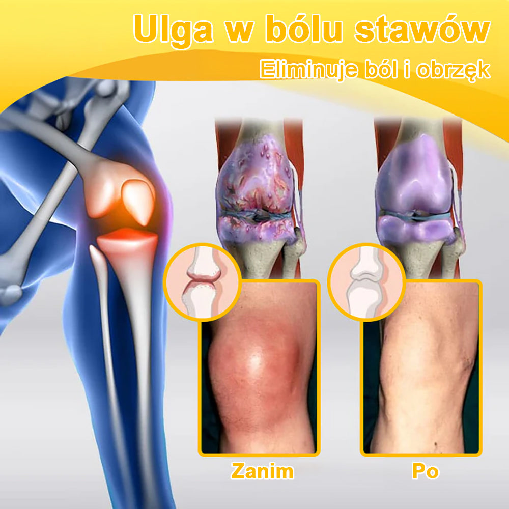 🌿Gbpurity™ Krem Do Regeneracji Stawów | Dla osób w średnim i późnym wieku